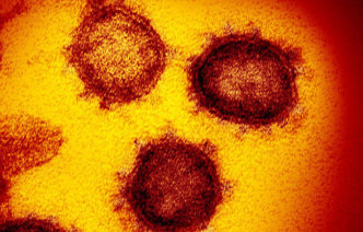 Coronavirus under the microscope