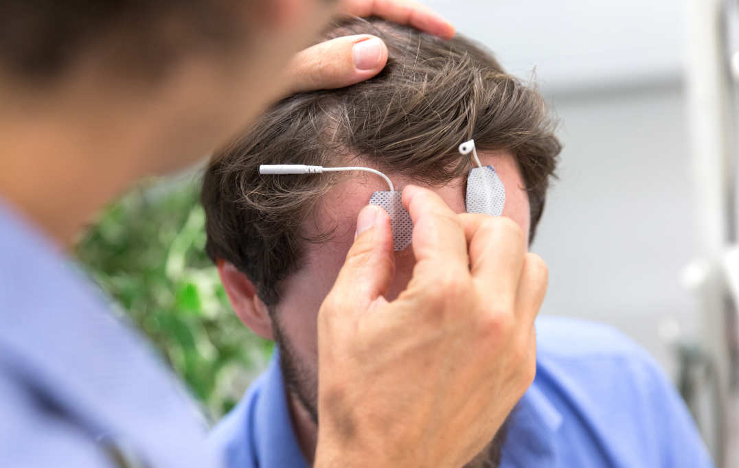 Applying electrodes to the scalp