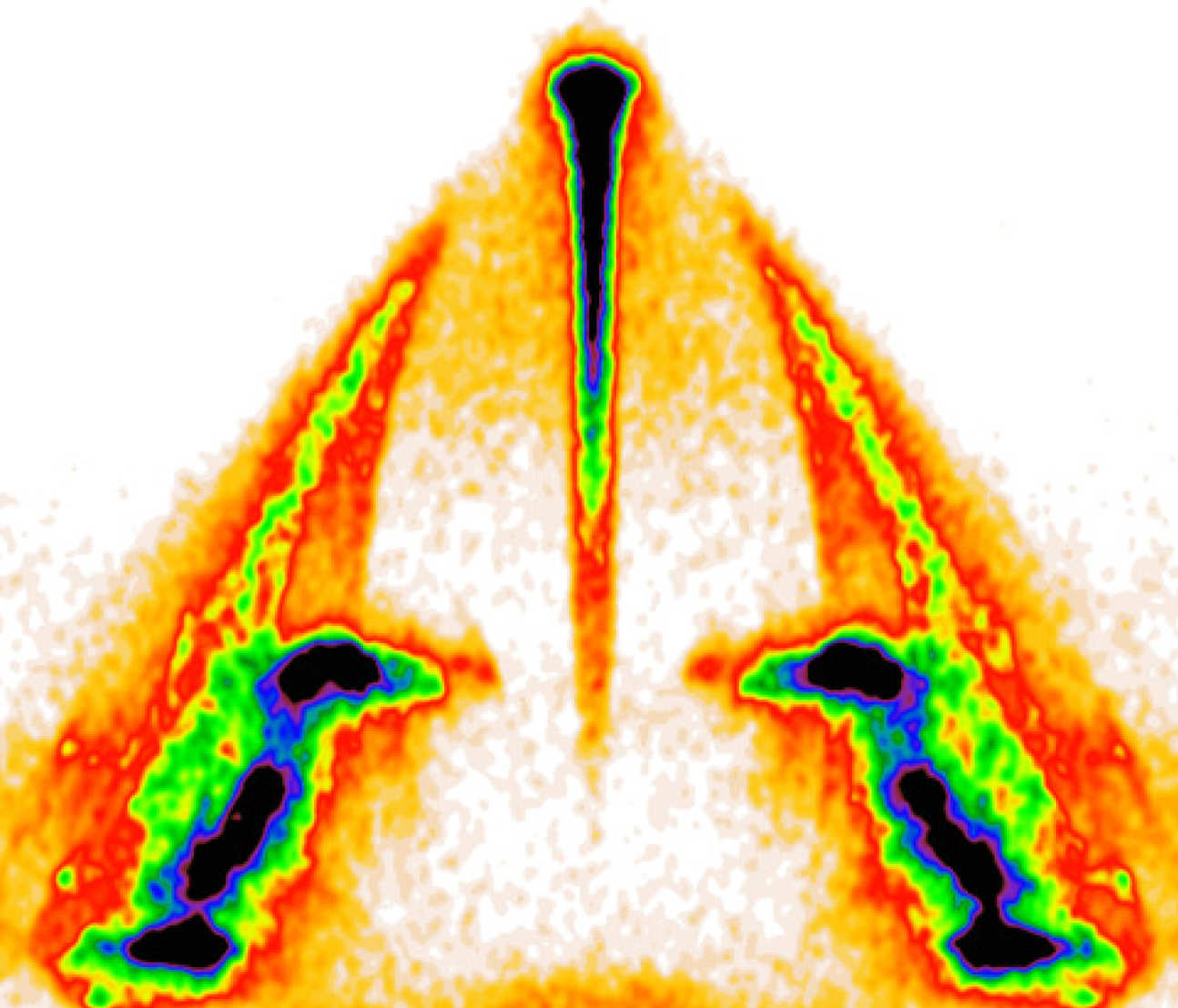 Another view of the beam concentration