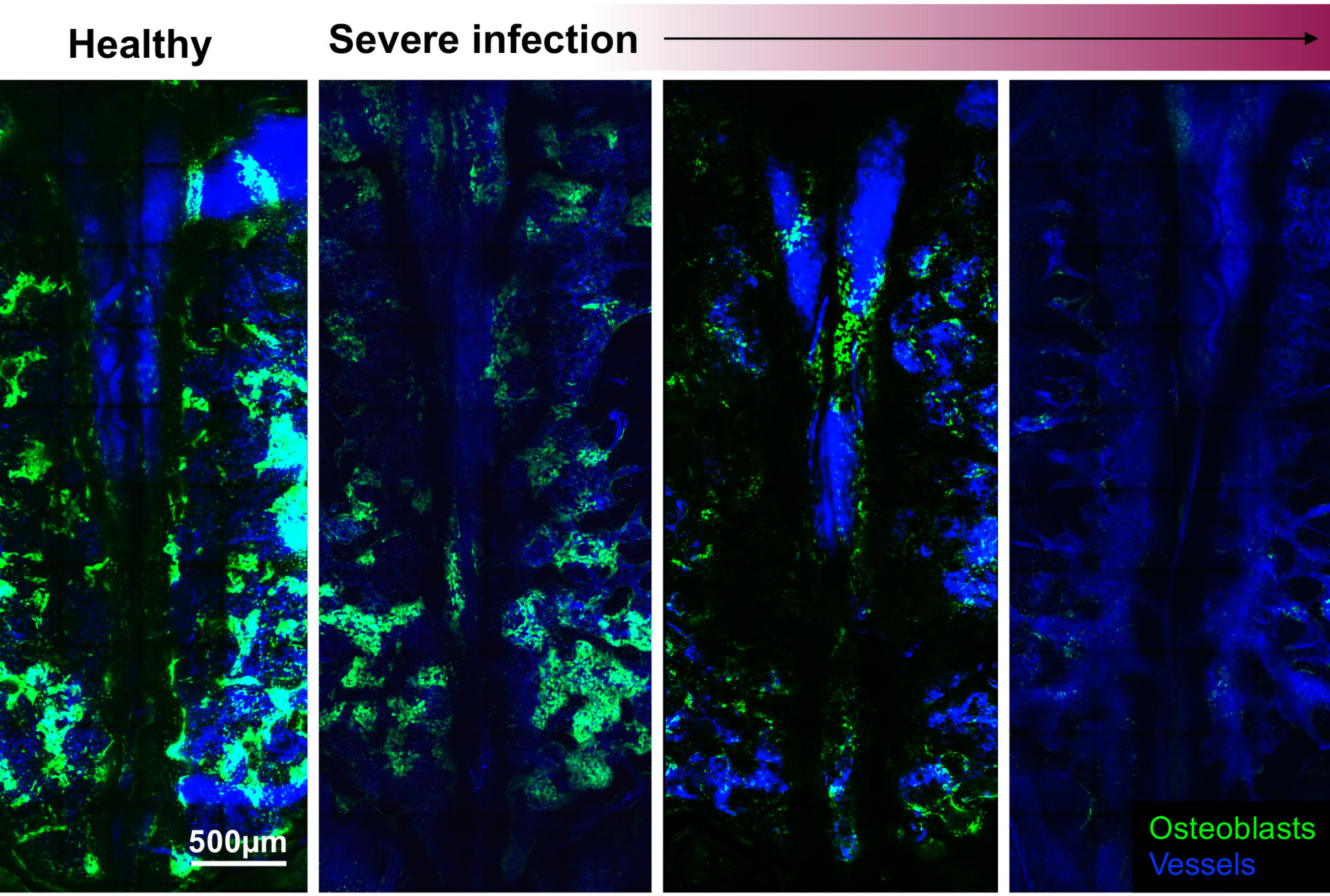 Four coloured microscopy images, showing diminishing green areas in line with increasing infection