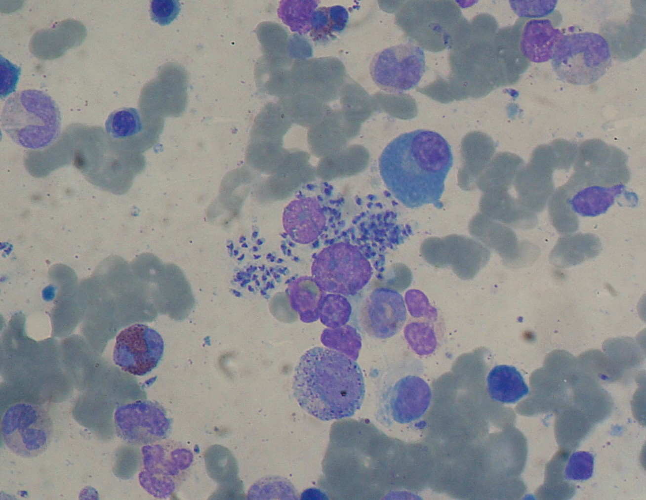 Laboratory image of Leishmania