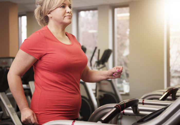 An overweight woman exercises on a treadmill