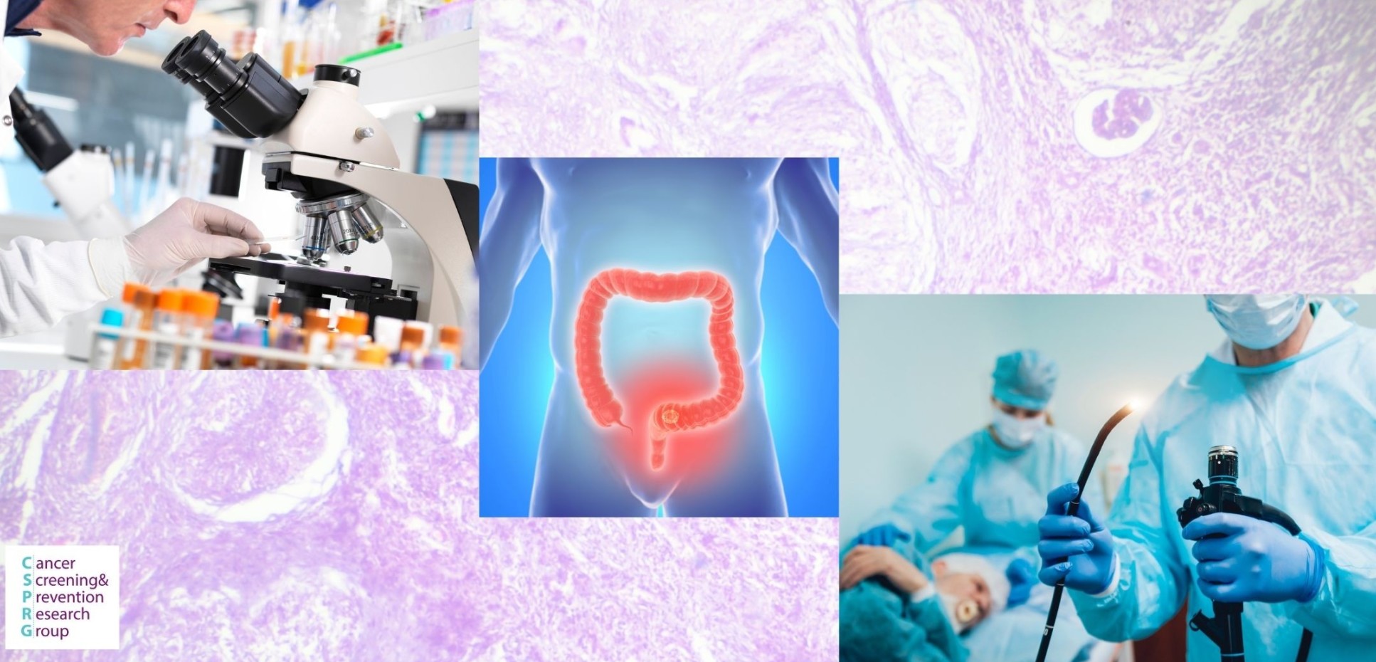 Collage of colorectal images