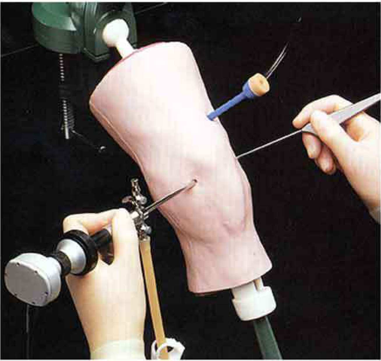  Standard Knee Arthroscopy Training
