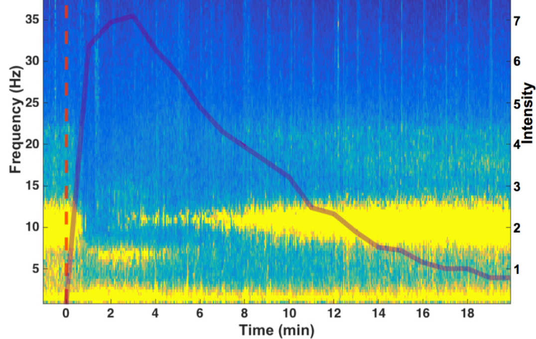 Ayahuasca compound changes brainwaves to vivid waking dream