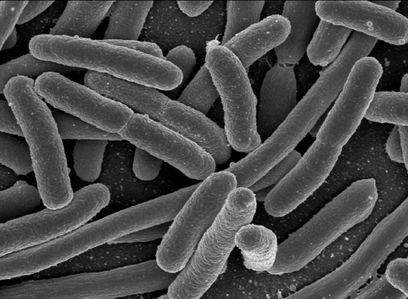 Rod-shaped E.coli bacteria 