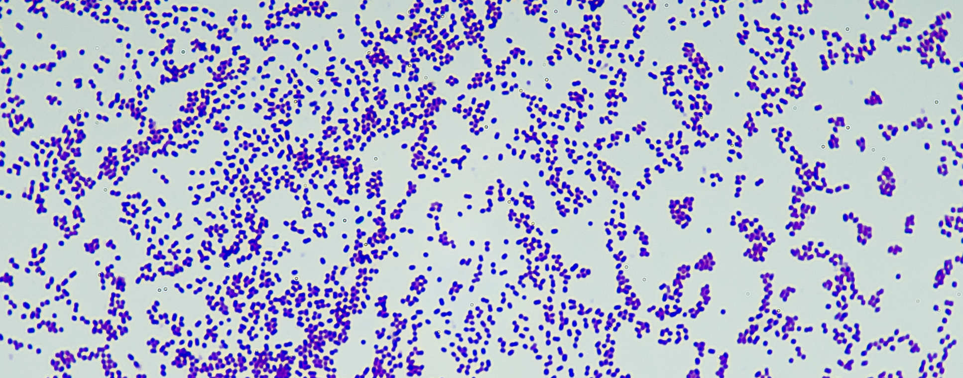 Gram positive Molecular Pathogenesis Faculty Of Medicine Imperial 