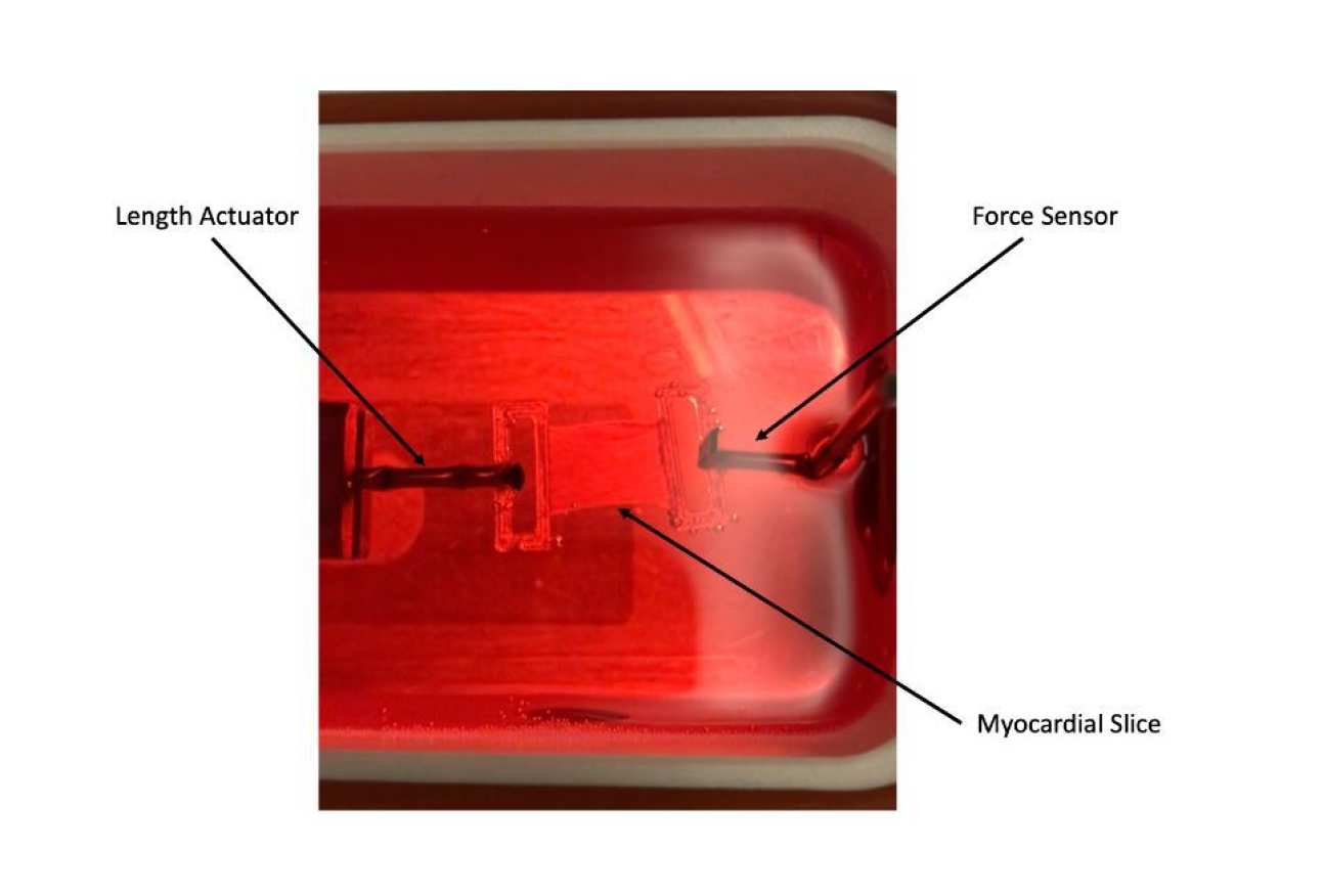 Heart tissue