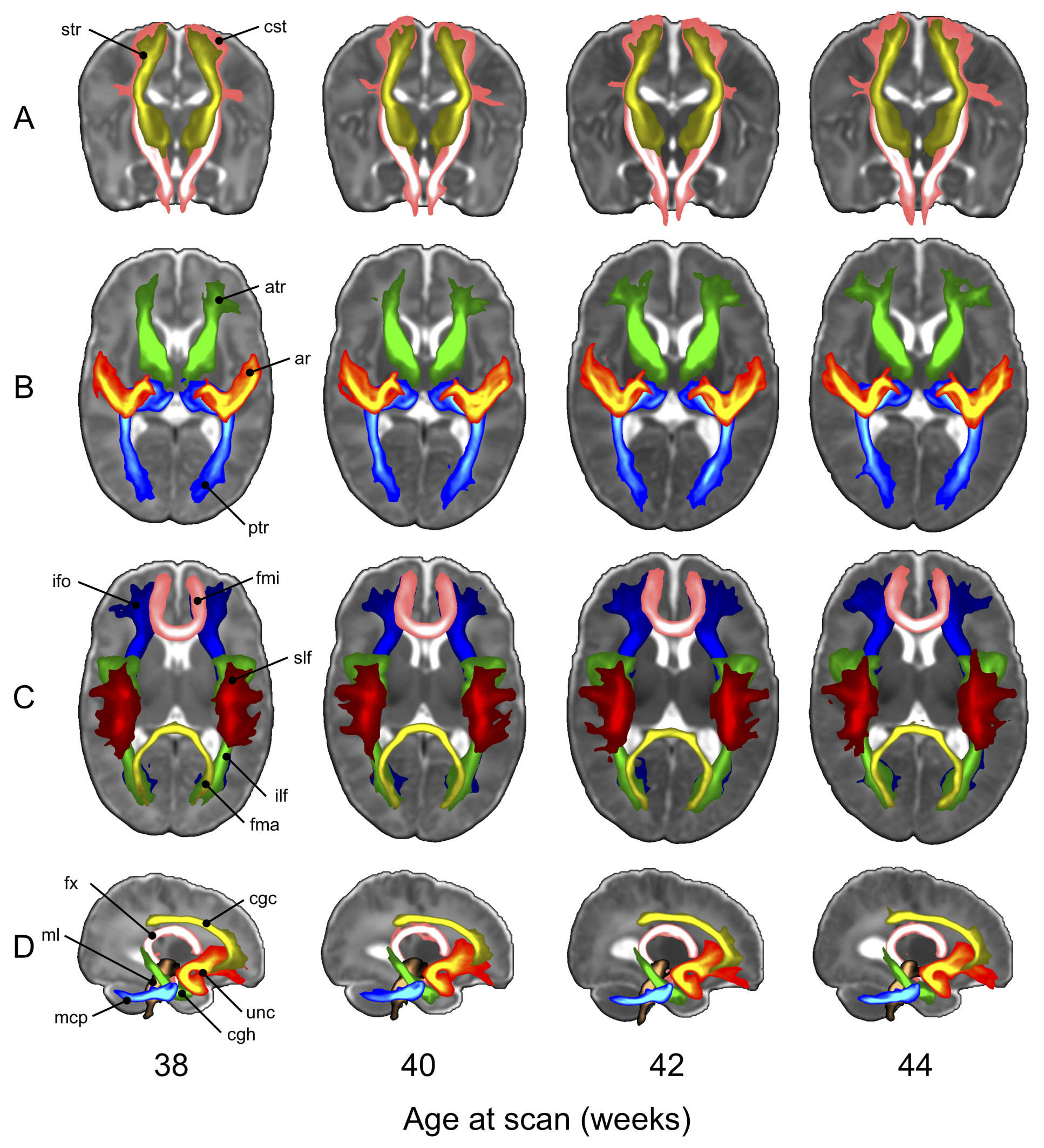 MRI scans of infant brains from the dHCP project