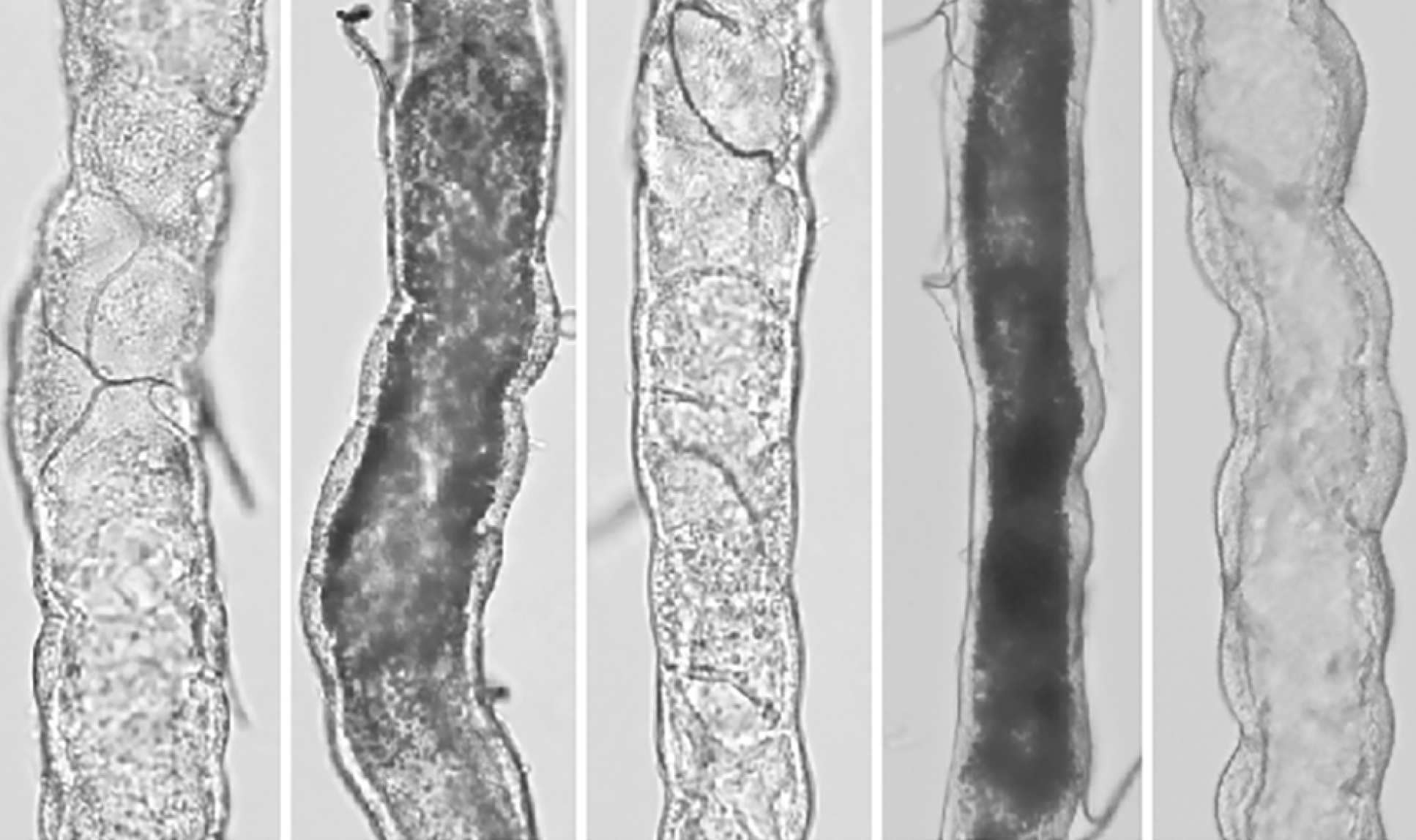 Montage of dissected fly renal tubules, alternating clear and dark, showing accumulation of uric acid crystals (dark) induced by chronic high-sugar feeding.