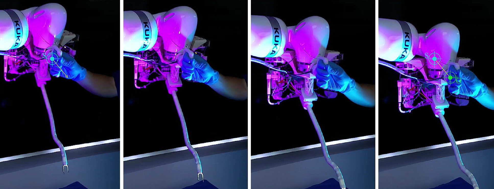 The i2 Snake Robotic Platform for Endoscopic Surgery | Imperial