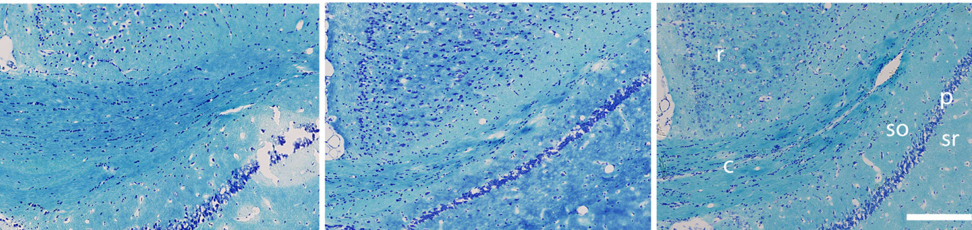 Three histological images showing the effects of xenon on brain tissue after TBI and xenon