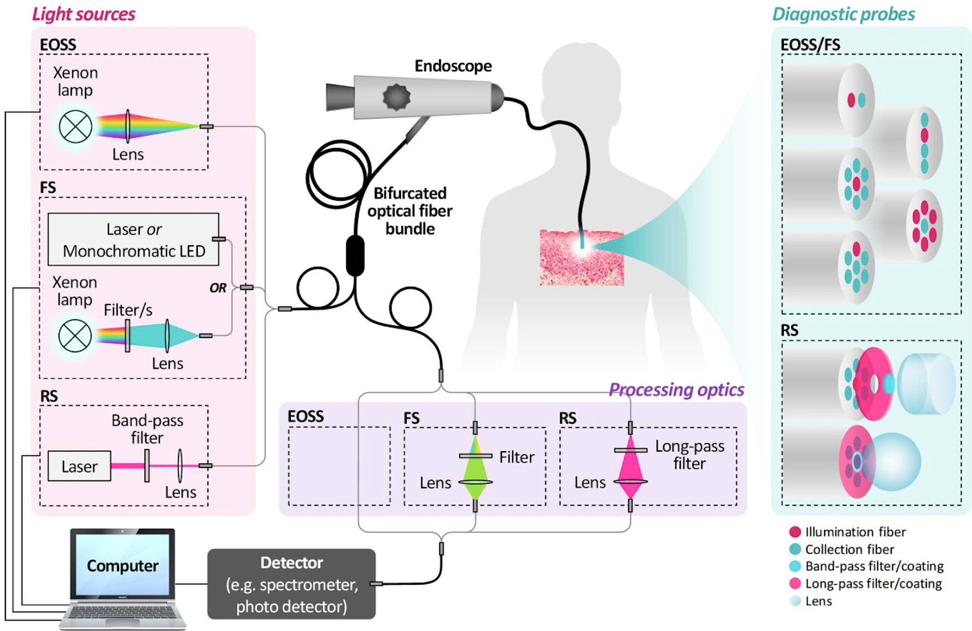 A comprehensive schematic of implementation settings of the point-based in vivo optical diagnostic techniques; elastic optical scattering spectroscopy (EOSS), fluorescence spectroscopy (FS), and Raman spectroscopy (RS).