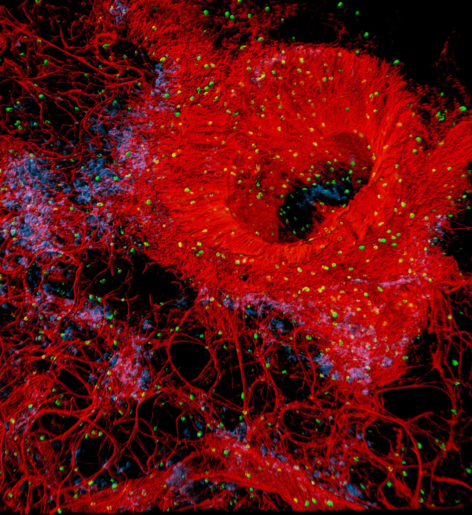 The image shows a small region of a human lung and its rich supply of blood vessels in red. The tiny green dots reveal immune cells called mast cells in the lungs and the blue dots are pericytes which are crucial cells for blood vessels to maintain their structure.  