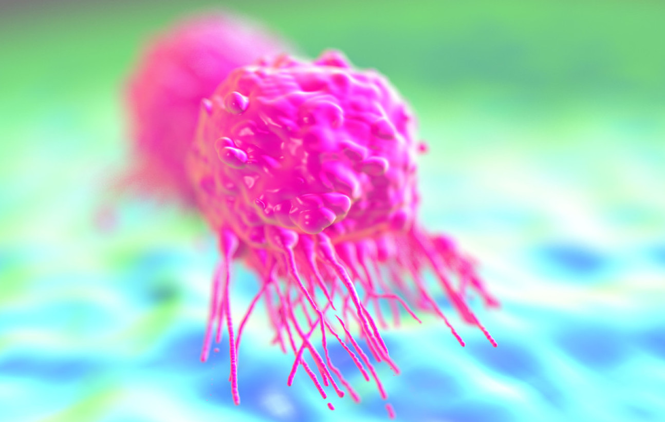 A breast cancer cell illustration