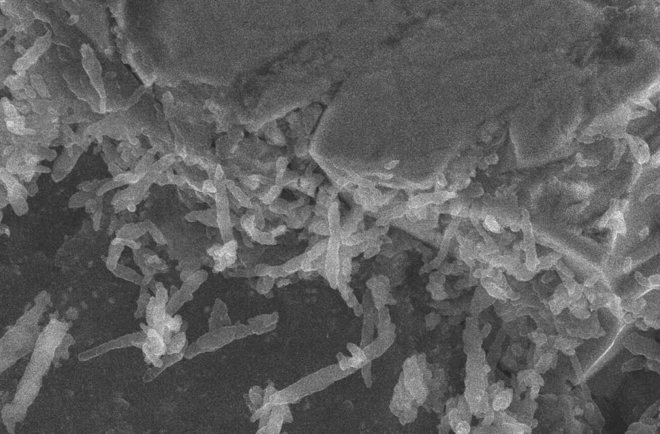 Asteroid-living bacteria under the microscope