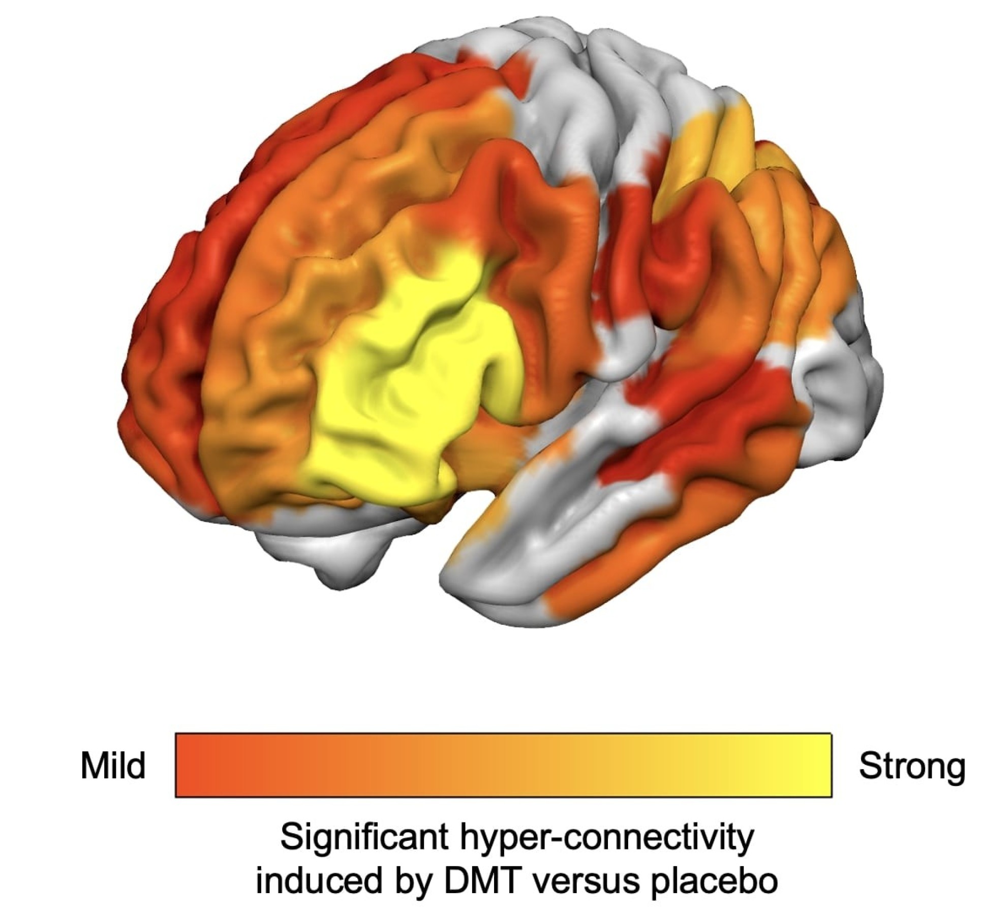 Advanced brain imaging study hints at how DMT alters perception of