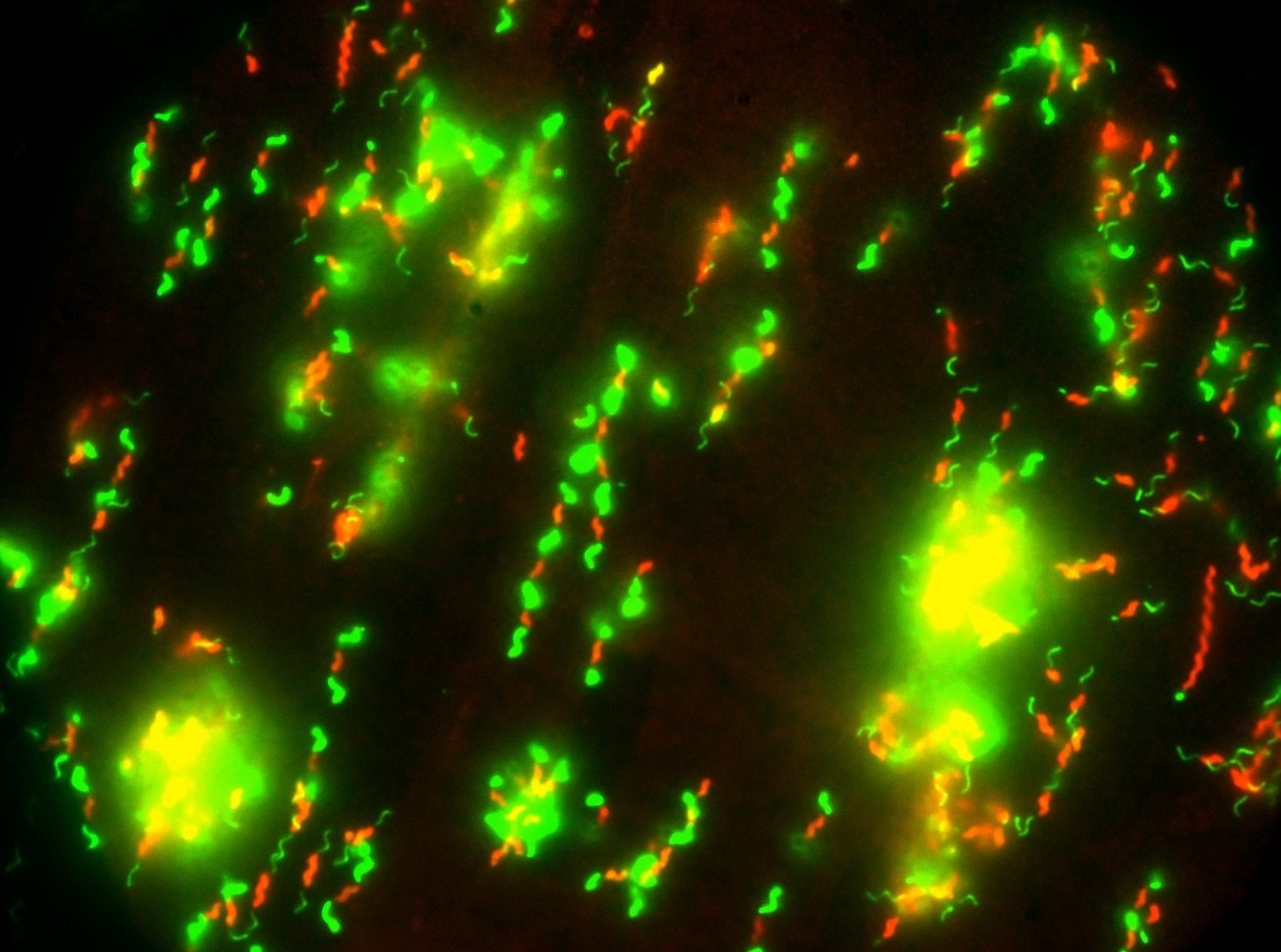 C. jejuni cells bodies (red) and flagella (green)