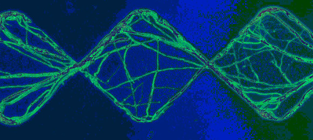 fungal hyphae in microfluidic device