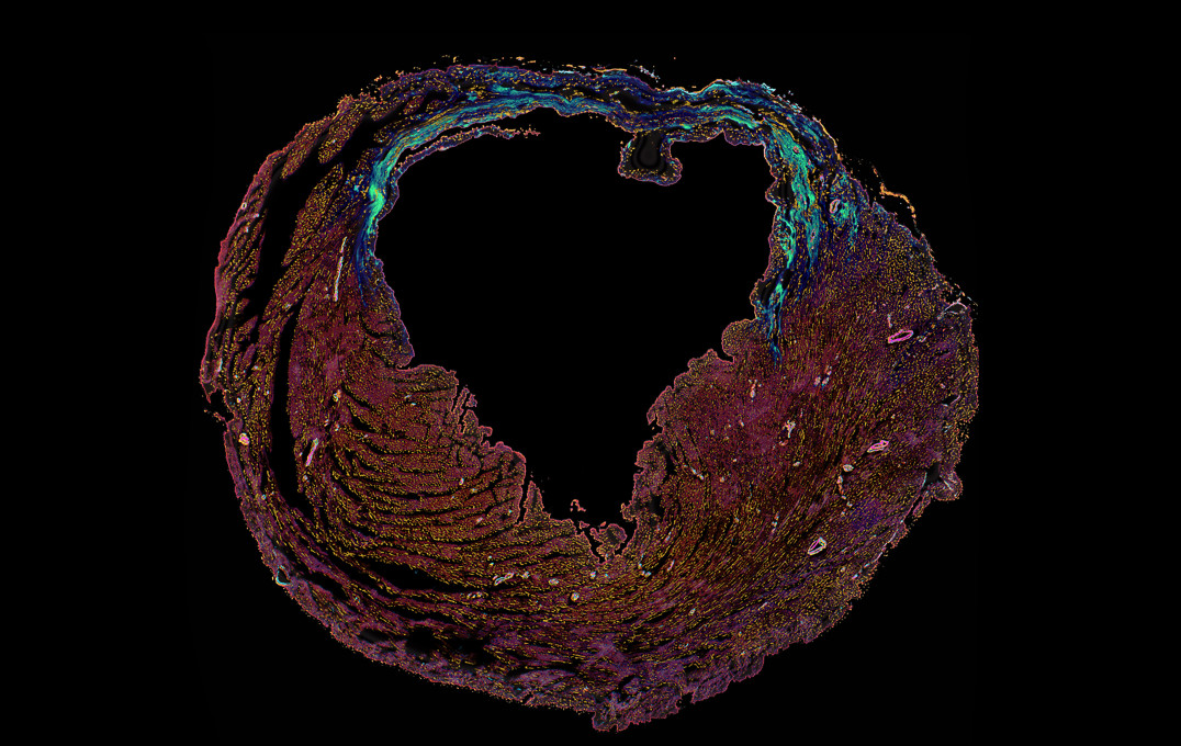 A heart within a heart by Christina Gkantsinikoudi and Dr Neil Dufton, Queen Mary University of London,