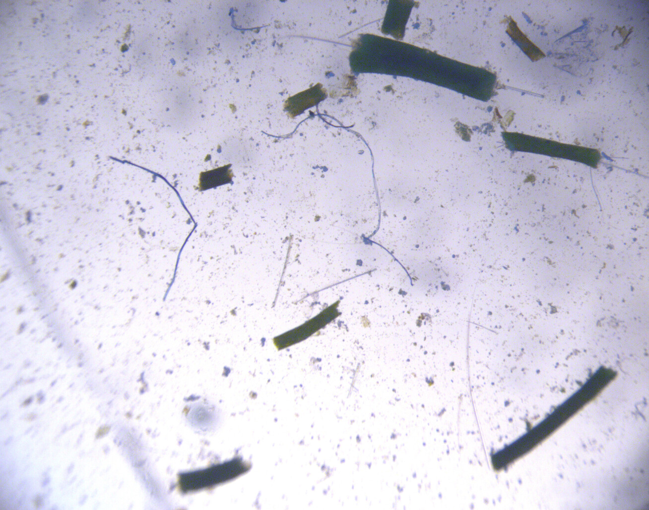 Microscopic image of Sinking faecal pellets from krill. 