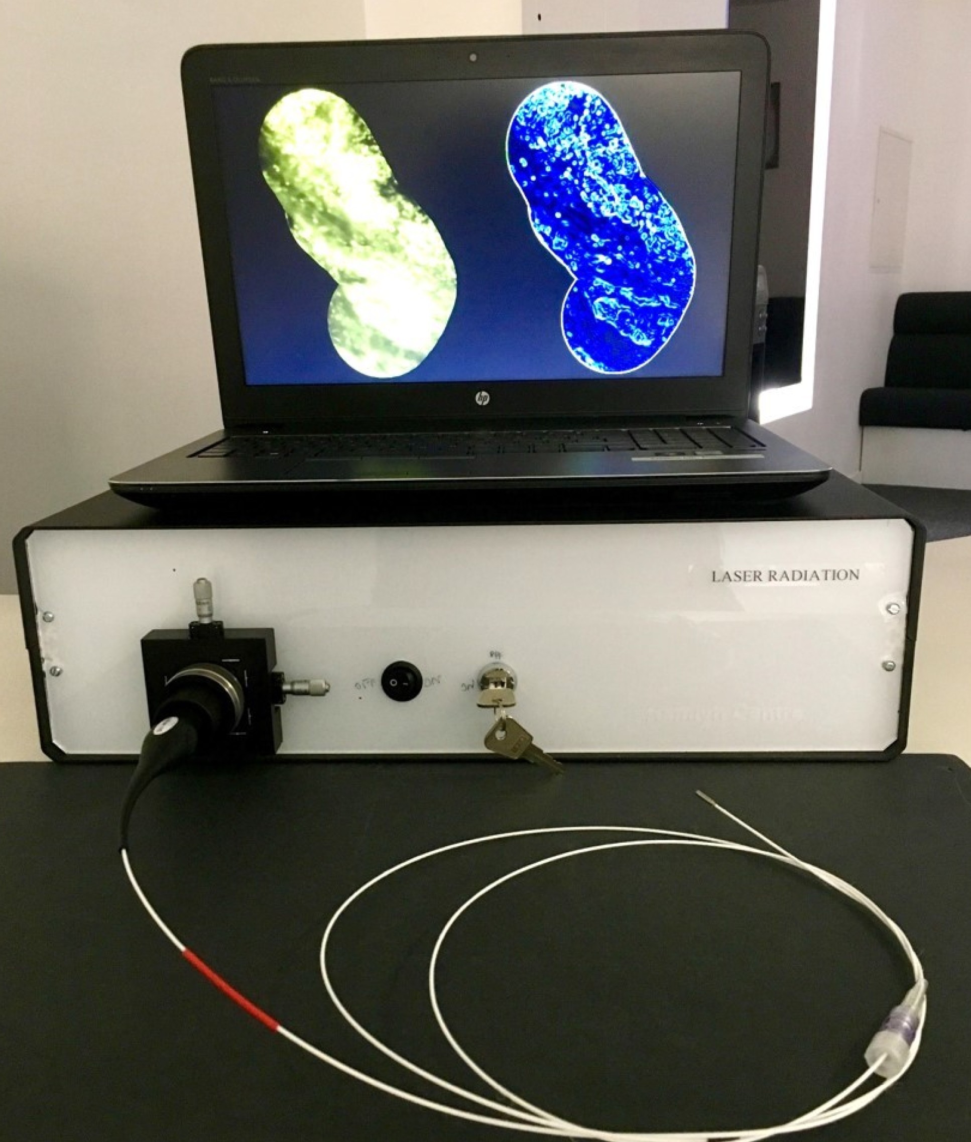 Photo showing images on a screen taken by the microscope