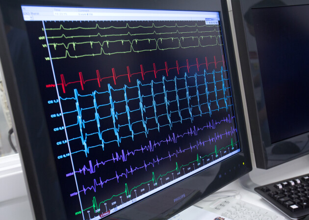 Screen showing heart trace