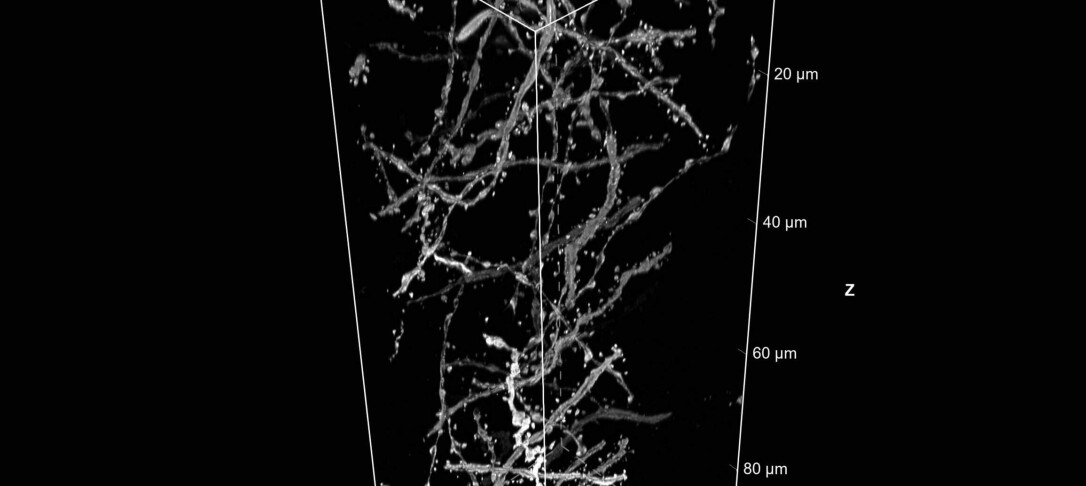 Reveal new confocal imaging potential with NSPARC: AX new super