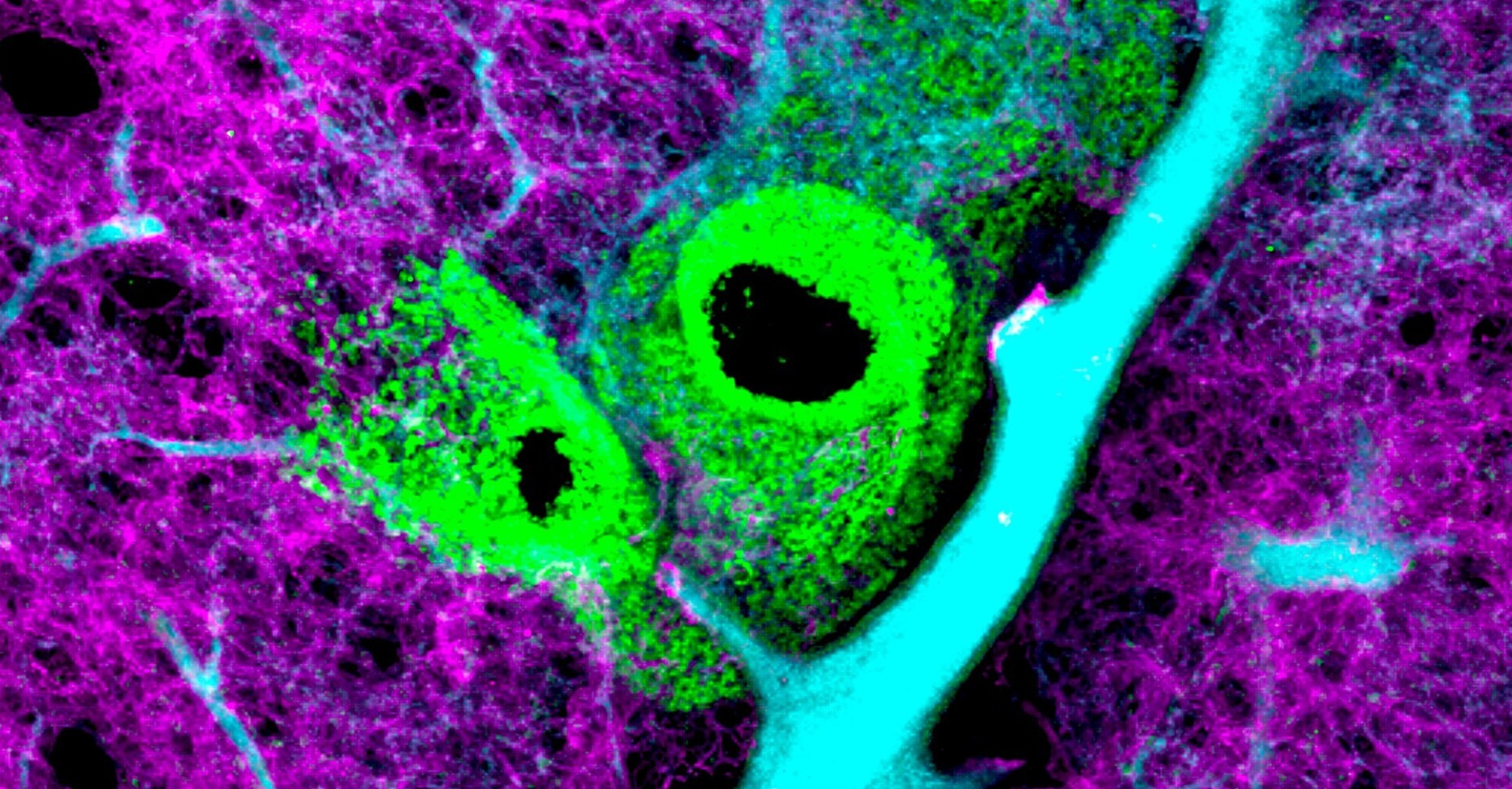 Image of lung epithelium (green), network of small blood vessels (purple) and larger blood vessels (blue).