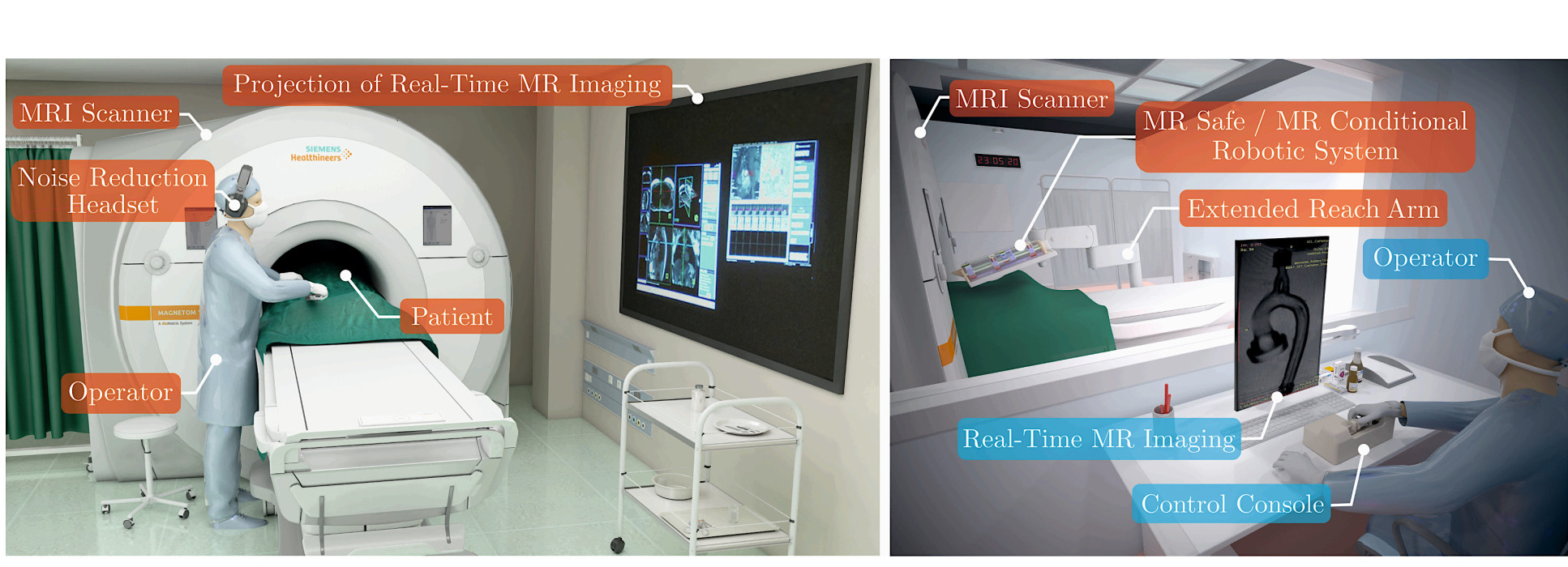 Manual Robotic MRI