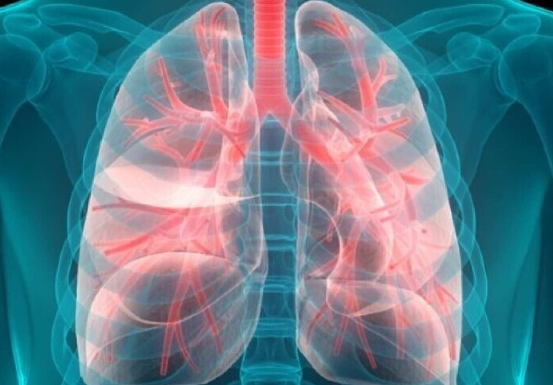 A chest X-ray, highlighting the lungs