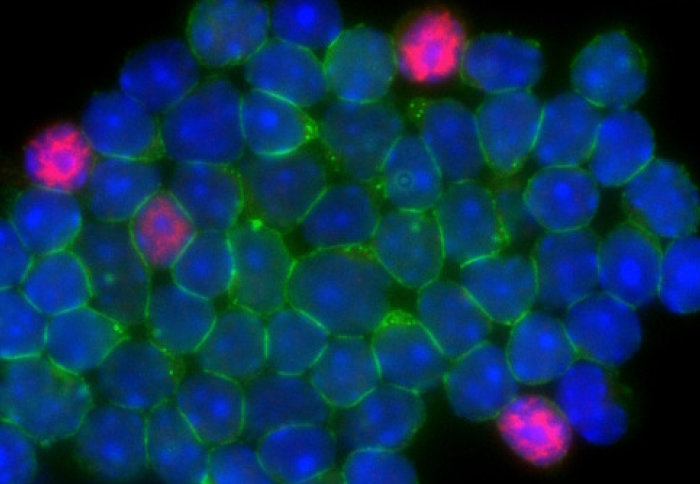 Growing T cells, coloured blue and pink