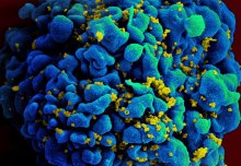 Anti-inflammatory drug reduces key complication risk in HIV-positive TB patients