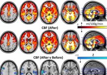 Brain scans