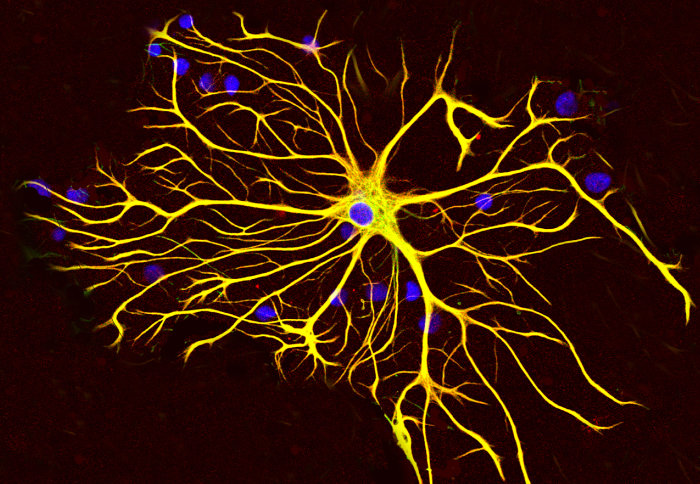 A rat astrocyte: A microscopic image of a star-shaped nerve cell with multiple branches
