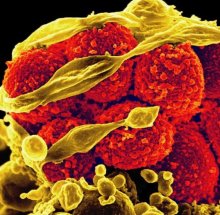 Scanning electron micrograph of methicillin-resistant Staphylococcus aureus bacteria (yellow, round items) killing and escaping from a human white cell
