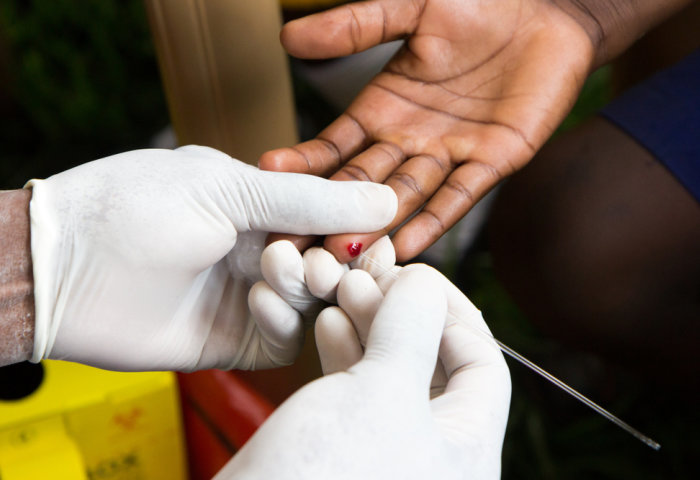  Test And Treat Reduces New HIV Infections By A Third In African 