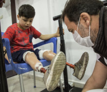 Photo of young boy with two prosthetic legs, being attended to by an adult man.