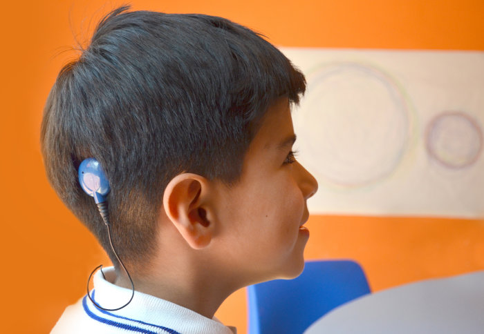 Photo of young boy with cochlear implant