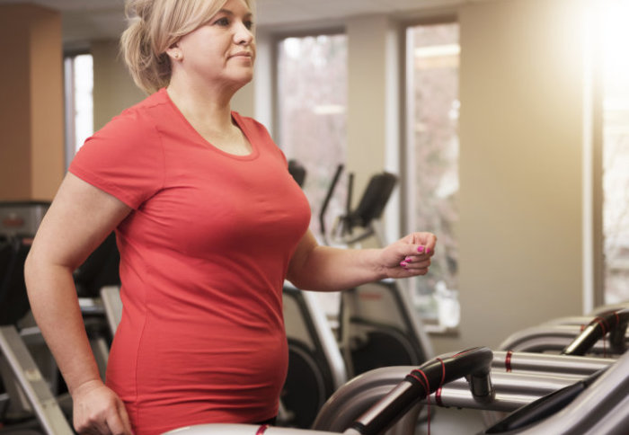 An overweight woman exercises on a treadmill