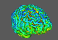 Lack of key protein reduces brain connections in schizophrenia