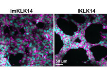 Molecular function of KLK14