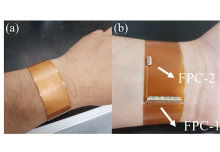 A Novel Flexible Wrist-Worn Thermotherapy and Thermoregulation Device