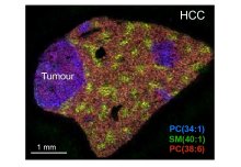 How do proliferating liver cells ‘rewire’ metabolism in regeneration and cancer?