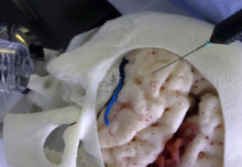 A Cross-Domain Transfer Learning Scheme for Robot-Assisted Microsurgery