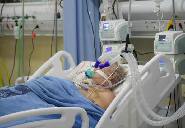 icu patient on ventilator