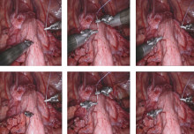 A Novel AI Framework of Image Reconstruction for Minimally Invasive Surgery