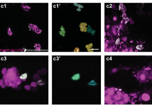 Tumours illuminated brightly and precisely with new biodegradable nanoprobe