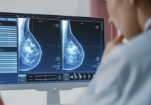 AI breast cancer screening project wins government funding for NHS trial