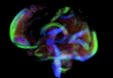 800 newborn brain scans made available to help clarify how some diseases develop